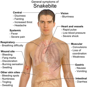 snake bites symptoms